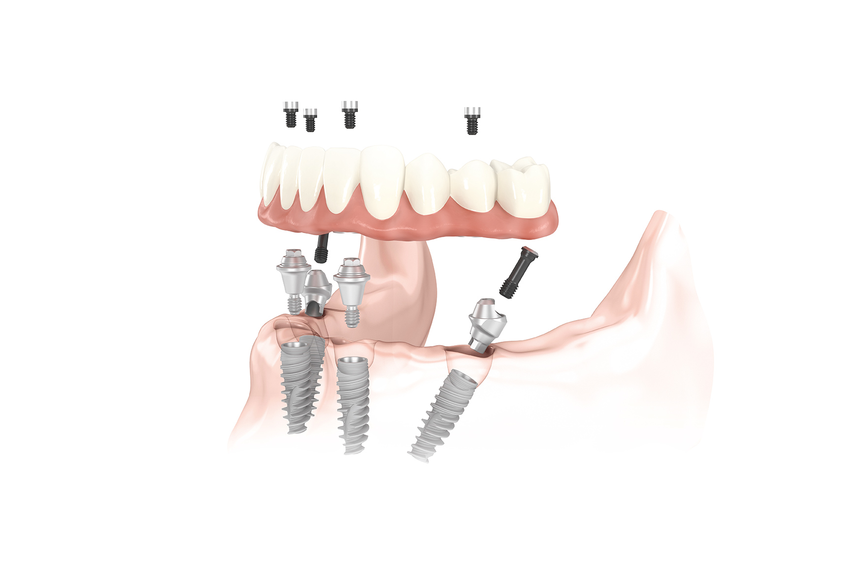 Slider Image 3